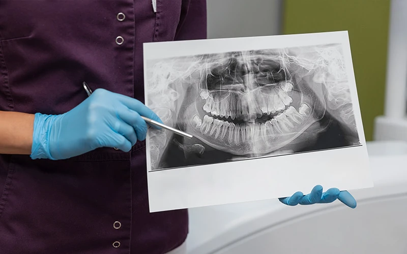 X-Rays-(if-necessary)